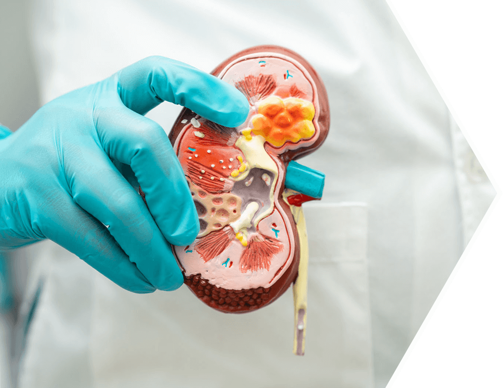 Urologie im Hansa Privatklinikum Graz